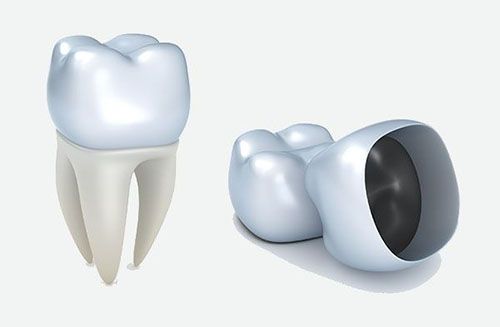 Dental Crowns | Smile Line Dental | Dentist Caroline Springs