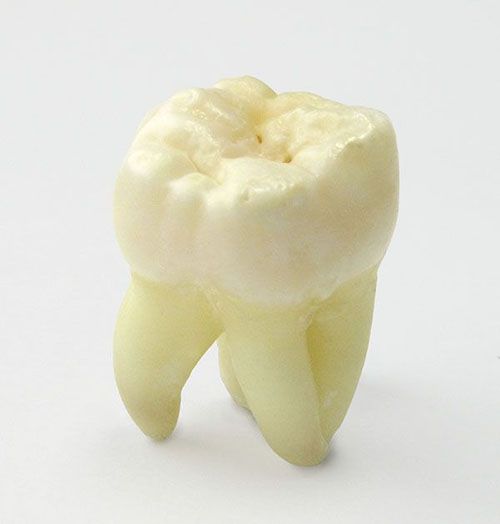 Wisdom Tooth | Smile Line Dental | Dentist Caroline Springs