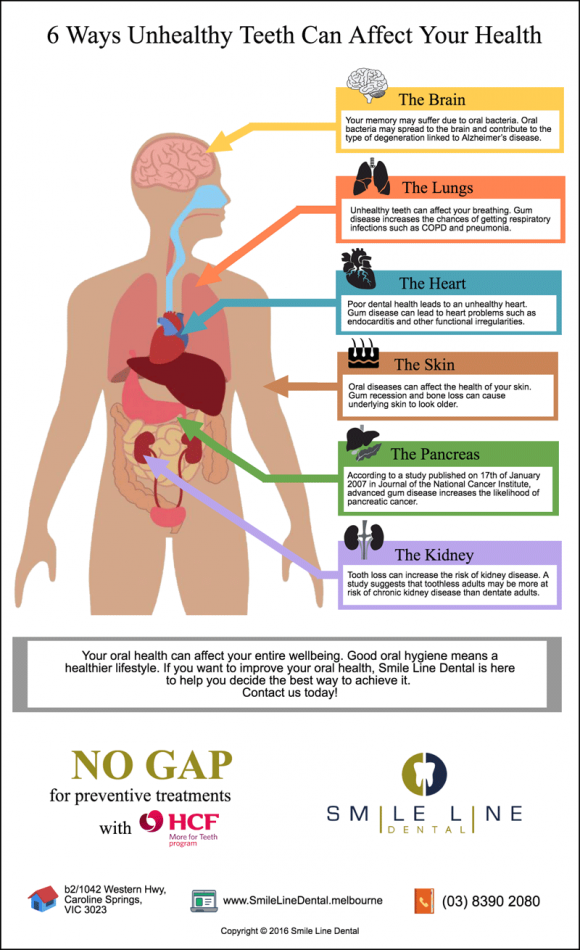 Caroline-Springs-Dentist-Trivia-6-Ways-Unhealthy-Teeth-Can-Affect-Your-Health